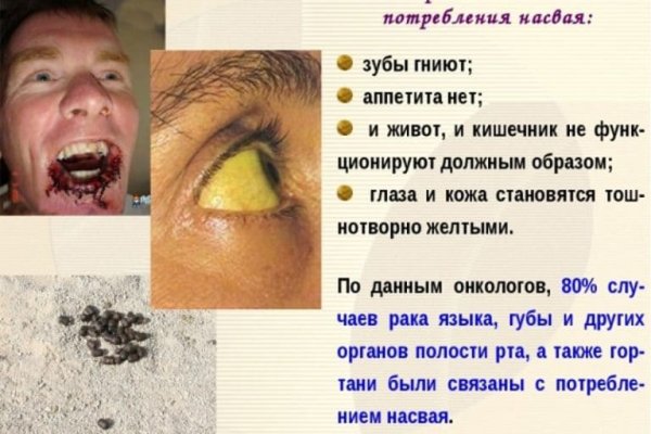 Не могу зайти на кракен